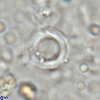 Reticulofenestra bukryi 26524