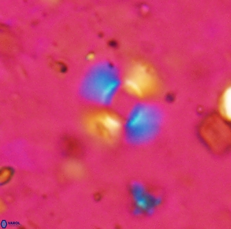 Reticulofenestra bukryi 30449