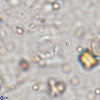 Reticulofenestra bukryi 30450