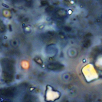 Reticulofenestra bukryi 30452