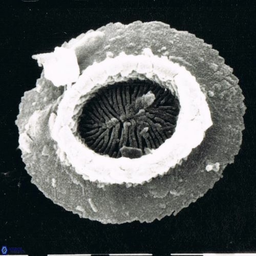 Reticulofenestra celticus 1473 12