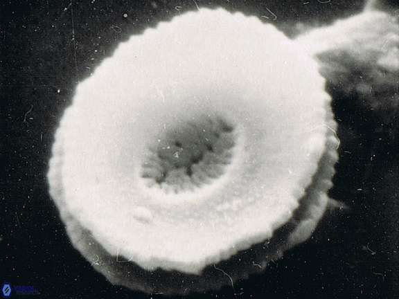 Reticulofenestra celticus 1152 10