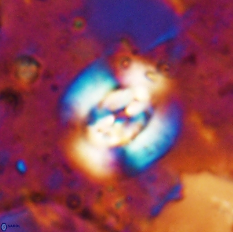 Reticulofenestra clemencesalleyae 19466