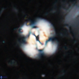 Reticulofenestra clemencesalleyae 19468