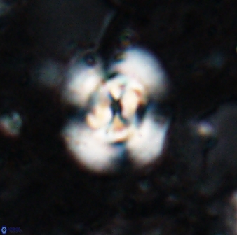 Reticulofenestra clemencesalleyae 19469