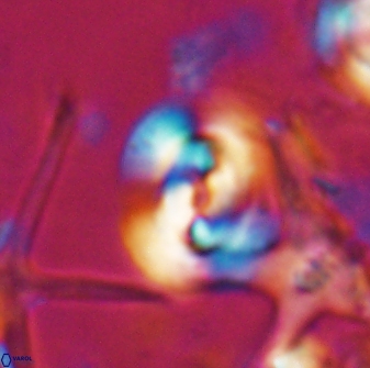 Reticulofenestra clemencesalleyae 26768