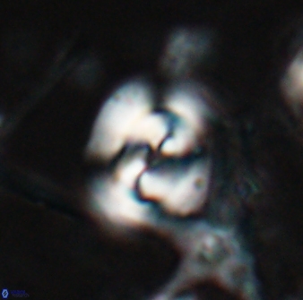 Reticulofenestra clemencesalleyae 26770