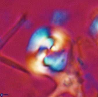 Reticulofenestra clemencesalleyae 26771