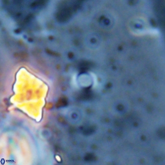 Reticulofenestra cruxii 30477