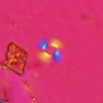 Reticulofenestra cruxii 30481