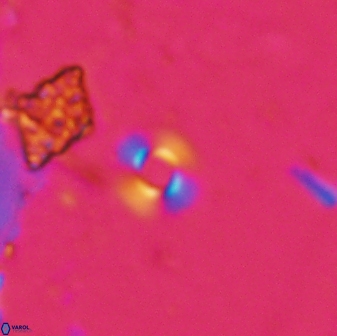 Reticulofenestra cruxii 30483