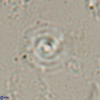 Reticulofenestra halimeerae VR 025148