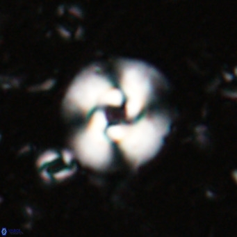 Reticulofenestra halimeerae VR 025141