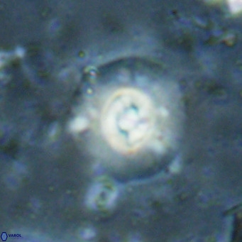 Reticulofenestra halimeerae VR 025154