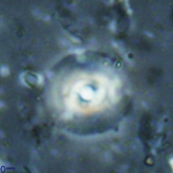 Reticulofenestra halimeerae VR 025156