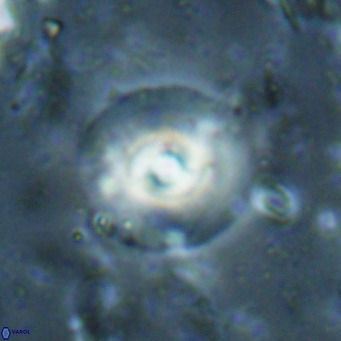 Reticulofenestra halimeerae VR 025158