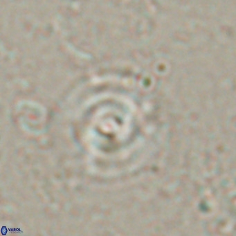 Reticulofenestra halimeerae VR 025152