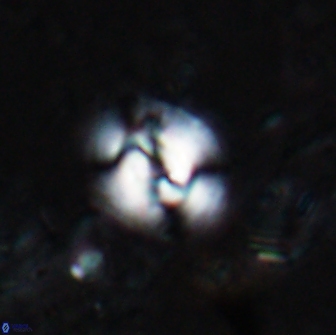 Reticulofenestra hesslandii 19501