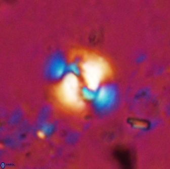 Reticulofenestra hesslandii 19502