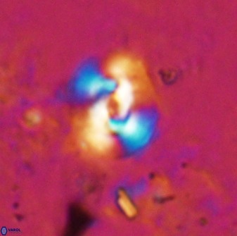 Reticulofenestra hesslandii 19504