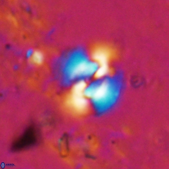 Reticulofenestra hesslandii 19506