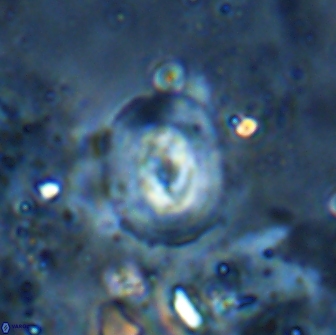 Reticulofenestra hesslandii 19508