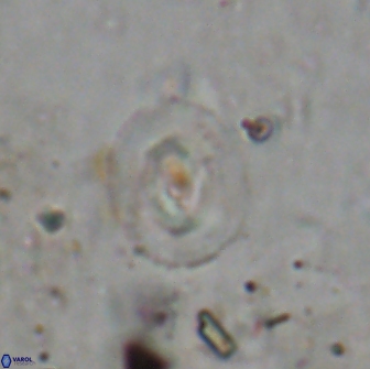 Reticulofenestra hesslandii 19511