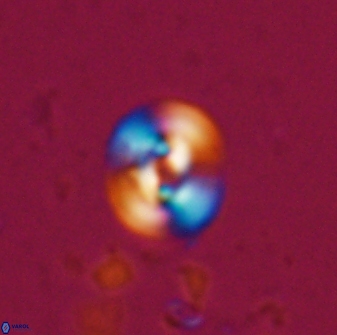 Reticulofenestra hesslandii 26425