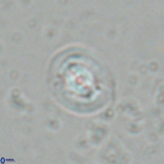 Reticulofenestra hesslandii 26435