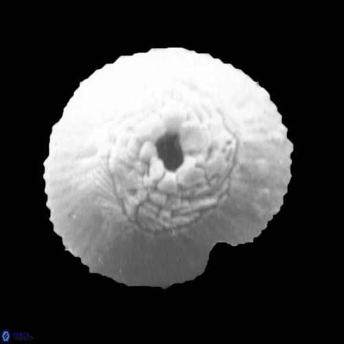 Reticulofenestra hesslandii 938 5