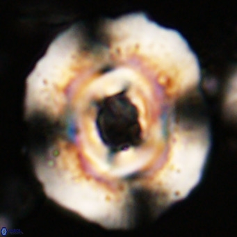 Reticulofenestra hillae VR 024370