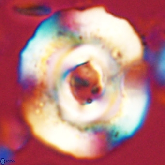 Reticulofenestra hillae VR 024371