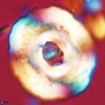 Reticulofenestra hillae VR 024372