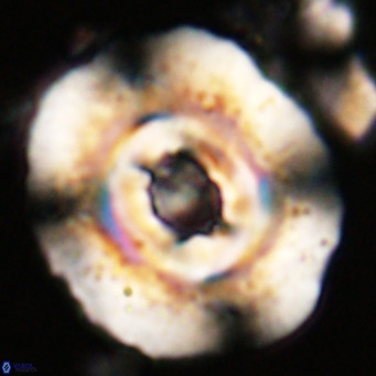 Reticulofenestra hillae VR 024373