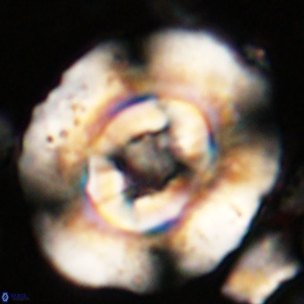 Reticulofenestra hillae VR 024374