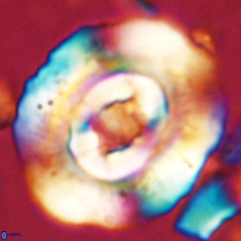 Reticulofenestra hillae VR 024375