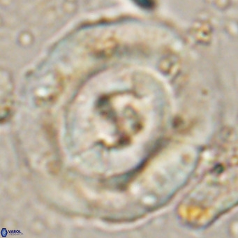 Reticulofenestra hillae VR 024377