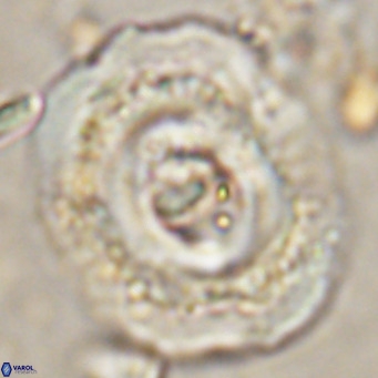 Reticulofenestra hillae VR 024379