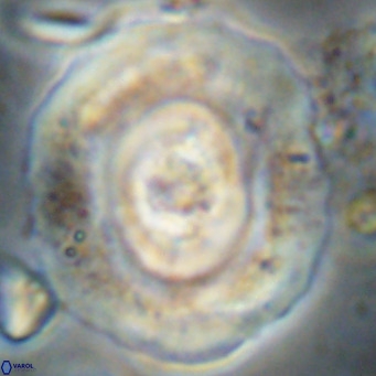 Reticulofenestra hillae VR 024381