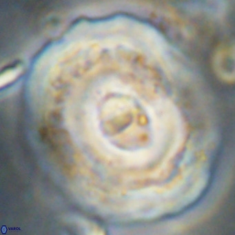 Reticulofenestra hillae VR 024382