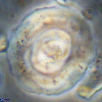 Reticulofenestra hillae VR 024383