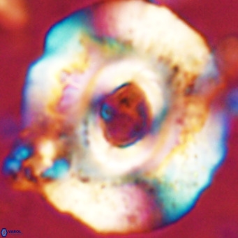 Reticulofenestra hillae VR 24285