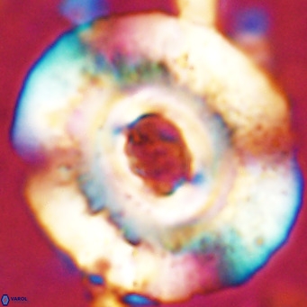 Reticulofenestra hillae VR 24289