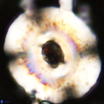 Reticulofenestra hillae VR 24290