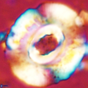 Reticulofenestra hillae VR 24292