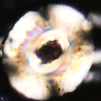 Reticulofenestra hillae VR 24294