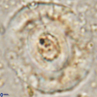 Reticulofenestra hillae VR 24298