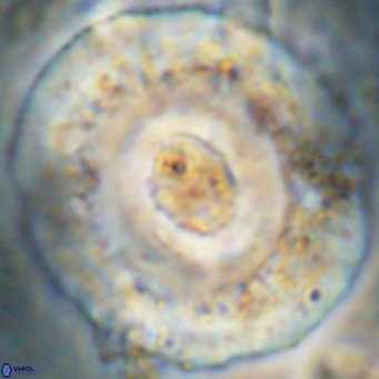 Reticulofenestra hillae VR 24299
