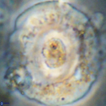 Reticulofenestra hillae VR 24300