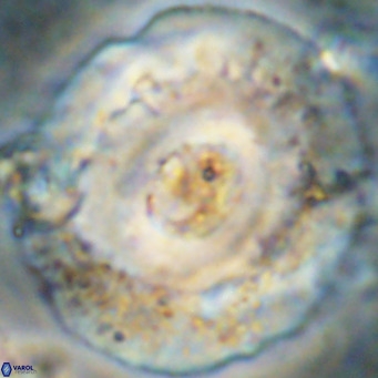 Reticulofenestra hillae VR 24301